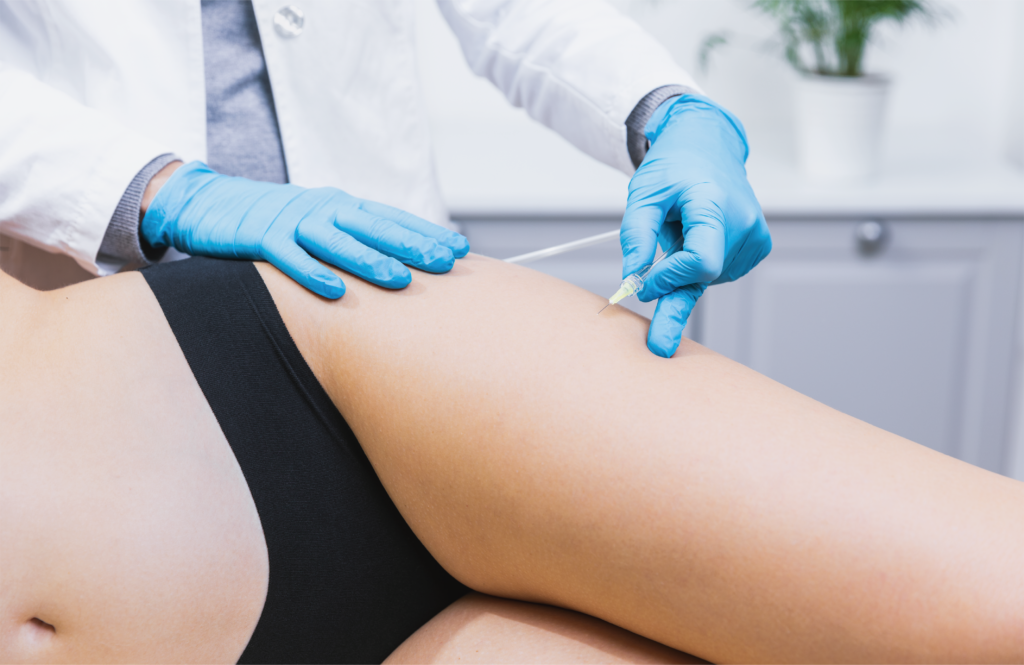 Trattamento enzimatico - mesoterapia - cellulite - adipe- carbossiterapia